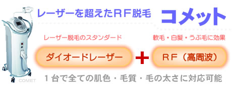 �R���b�g�i���[�U�[�𒴂���RF�E�сj