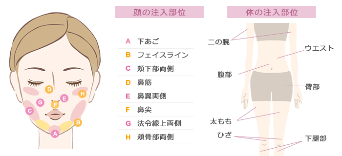 脂肪溶解注射 スキンクリニック山本皮フ科 脂肪溶解注射 スキンクリニック山本皮フ科